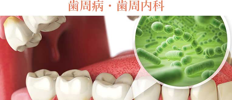 歯周病・歯周内科