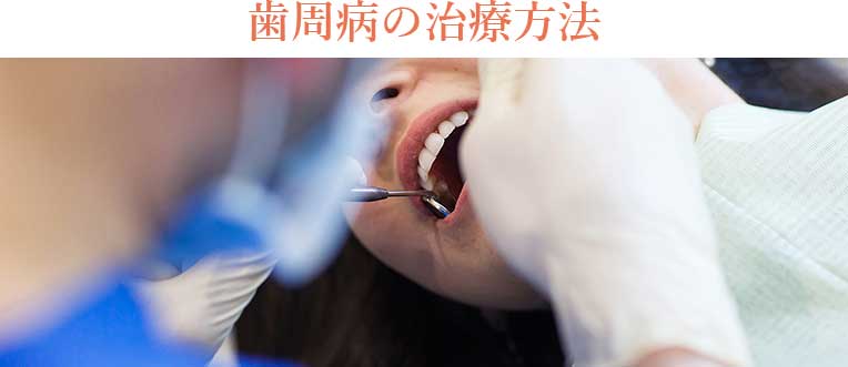 歯周病の治療方法