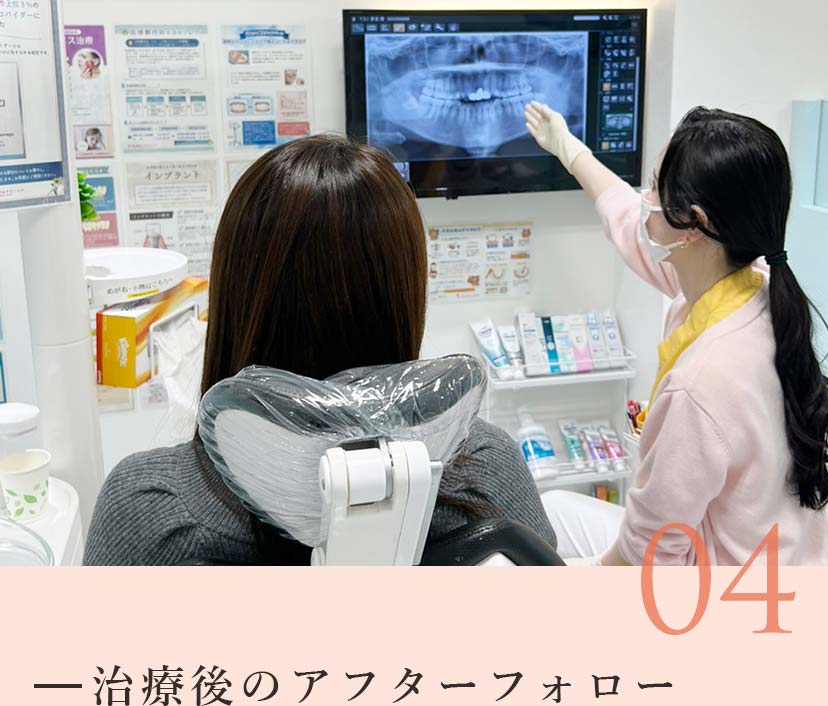 治療後のアフターフォロー